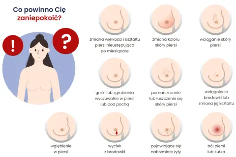Grafika pokazuje objawy, które mogą świadczyć o problemach z piersiami, np. zmiany kształtu, guzki, wyciek z brodawki, ból. Zwróć uwagę na **twarde sutki** i inne niepokojące zmiany.