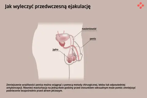 Ilustracja układu rozrodczego męskiego z zaznaczonym penisem, jądrami i nasieniowodem. Tekst omawia metody leczenia przedwczesnej ejakulacji, np. zmniejszenie wrażliwości penisa, by nie dochodzić zbyt szybko.