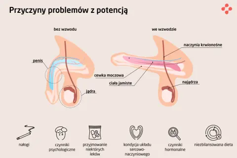 Anatomia penisa bez i we wzwodzie. Przyczyny problemów z potencją: nałogi, czynniki psychologiczne, leki, kondycja sercowo-naczyniowa, hormony, dieta. Wyposzczony facet co to znaczy?