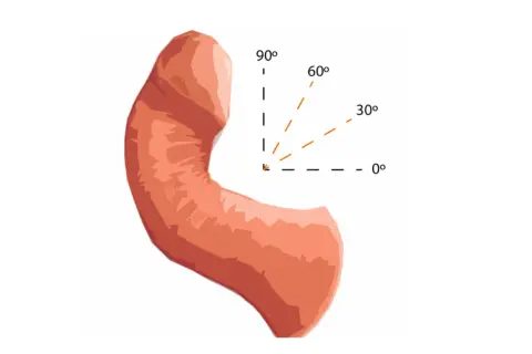 Ilustracja przedstawia wygląd penisa z zaznaczonymi kątami: 0°, 30°, 60° i 90°.